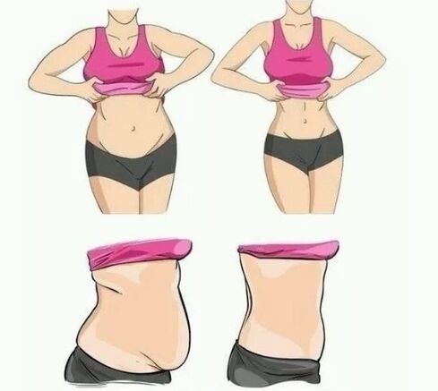 失去腹部